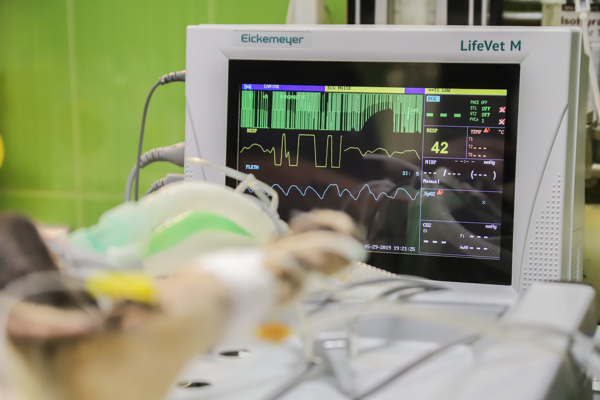 Remote Patient Monitoring (RPM) Technology for Heart Patients in 2026: How IoT Devices Are Transforming Home Healthcare